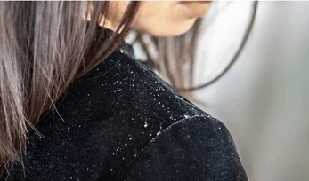 Batana oil Batana oil